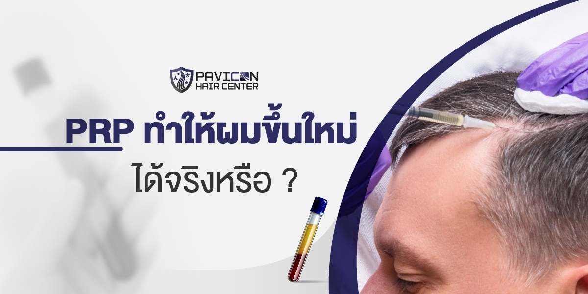 PRP ทำให้ผมขึ้นใหม่ได้จริงหรือ ? 