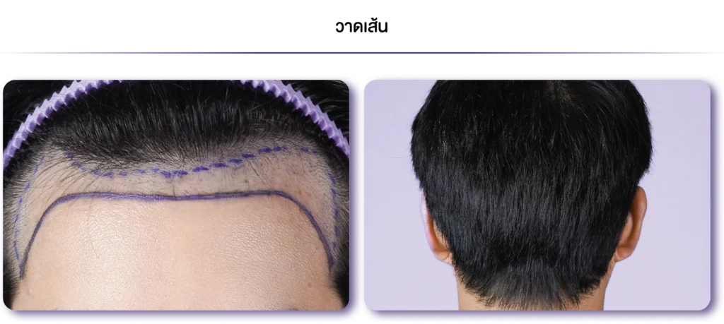 1-1080 x 484