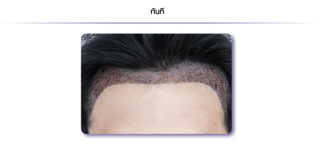 2-1080 x 486