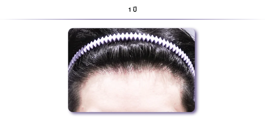 3-1080 x 486