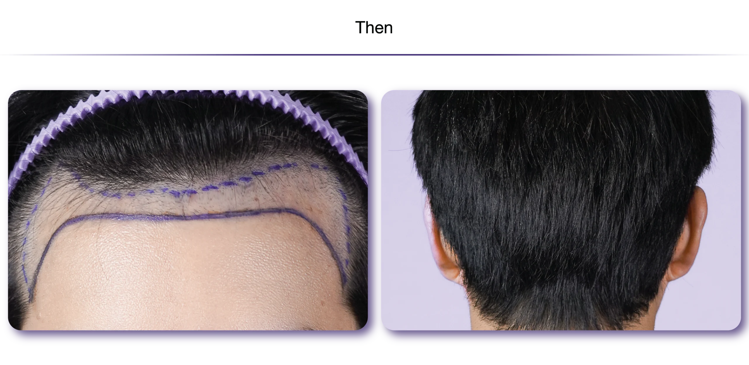 Eng-Non Shaven-24