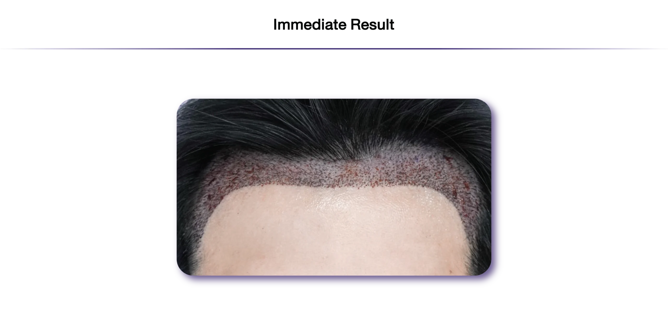Eng-Non Shaven-25