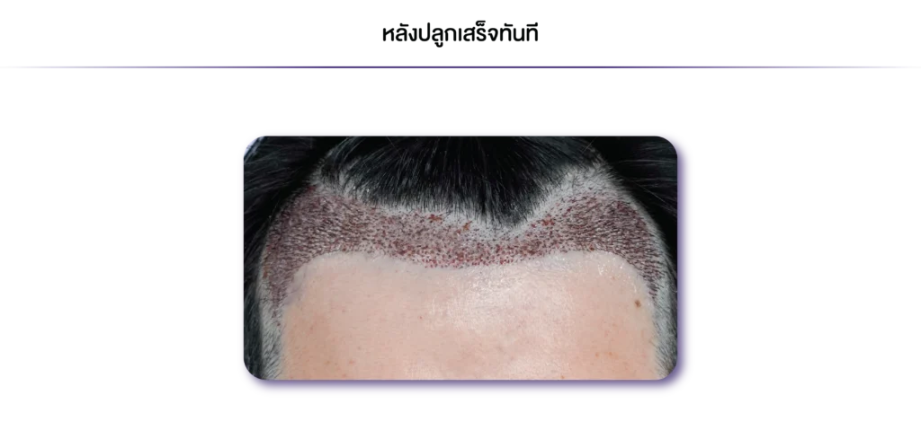 Review-AMF-ทันที-05