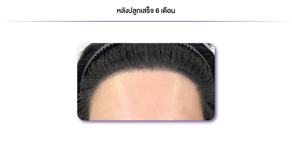 Review-DHI-6 เดือน-08