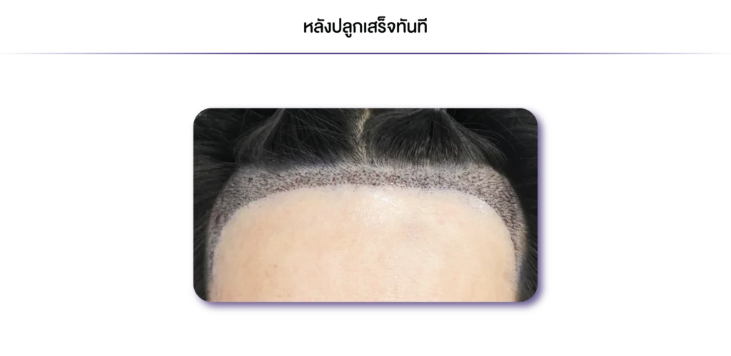 Review-DHI-ทันที-07