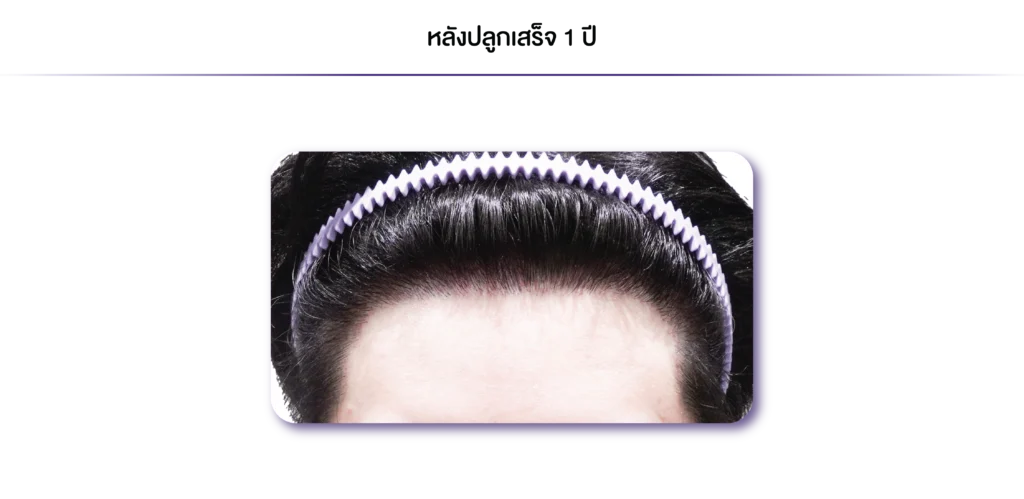 Review-Non Shaven-1 ปี-12