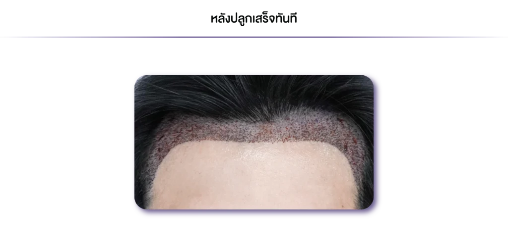 Review-Non Shaven-ทันที-11
