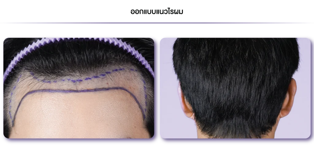 Review-Non Shaven-ออกแบบแนวไรผม-04