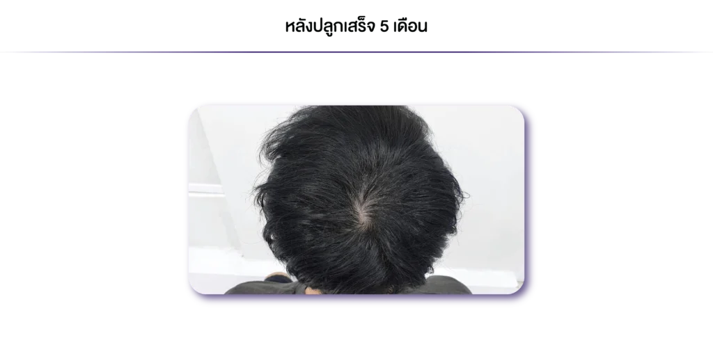 Review-iStemZ-5 เดือน-14