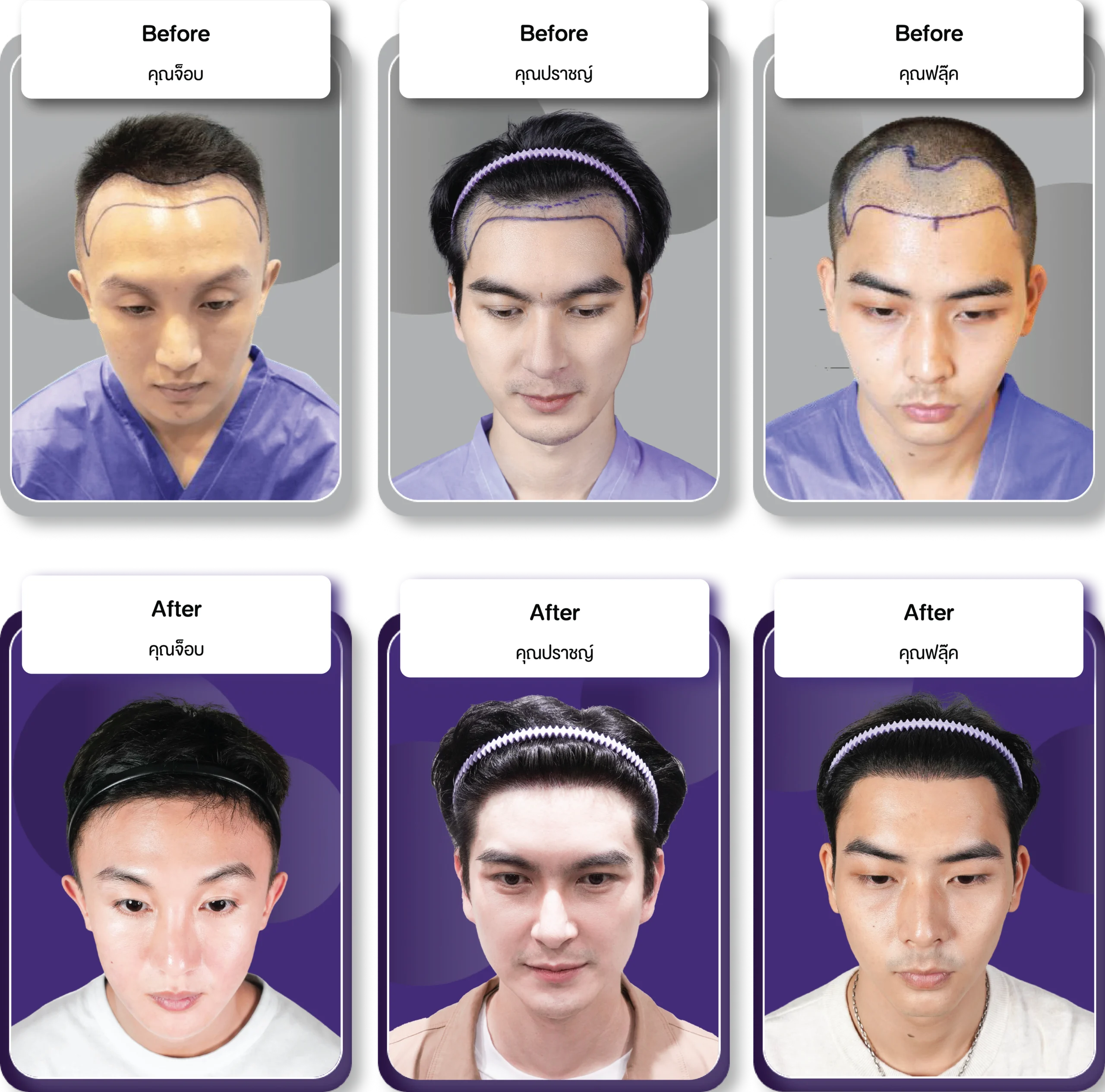 Thai-Customer Review-แก้รูปคุณปราชญ์-07